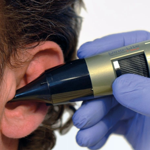 Otoscópios